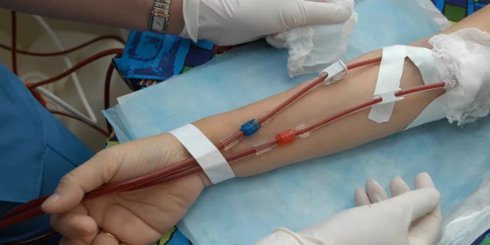 خدمة الغسيل الكلوي المنزلي من نبض الحياة للرعاية المنزلية