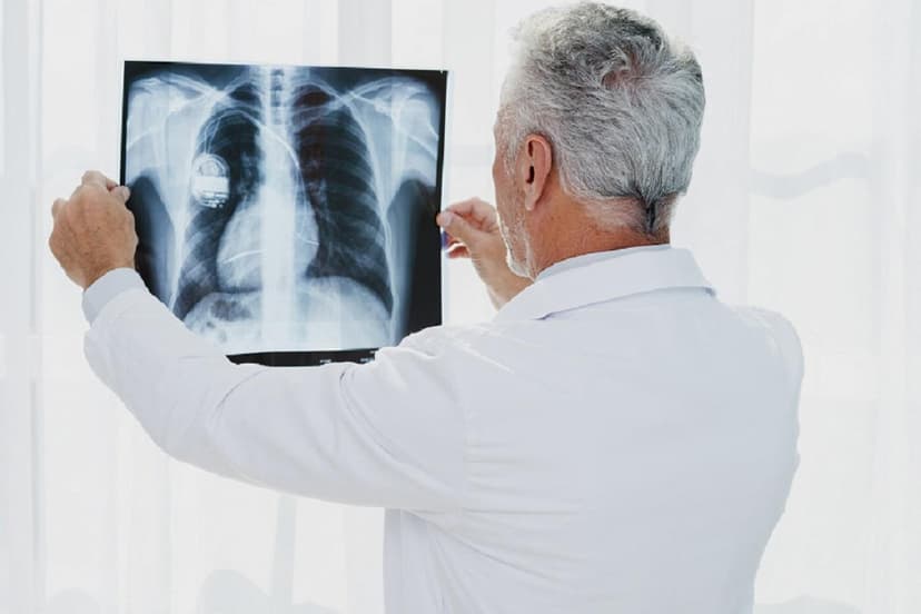 الأشعة المنزلية